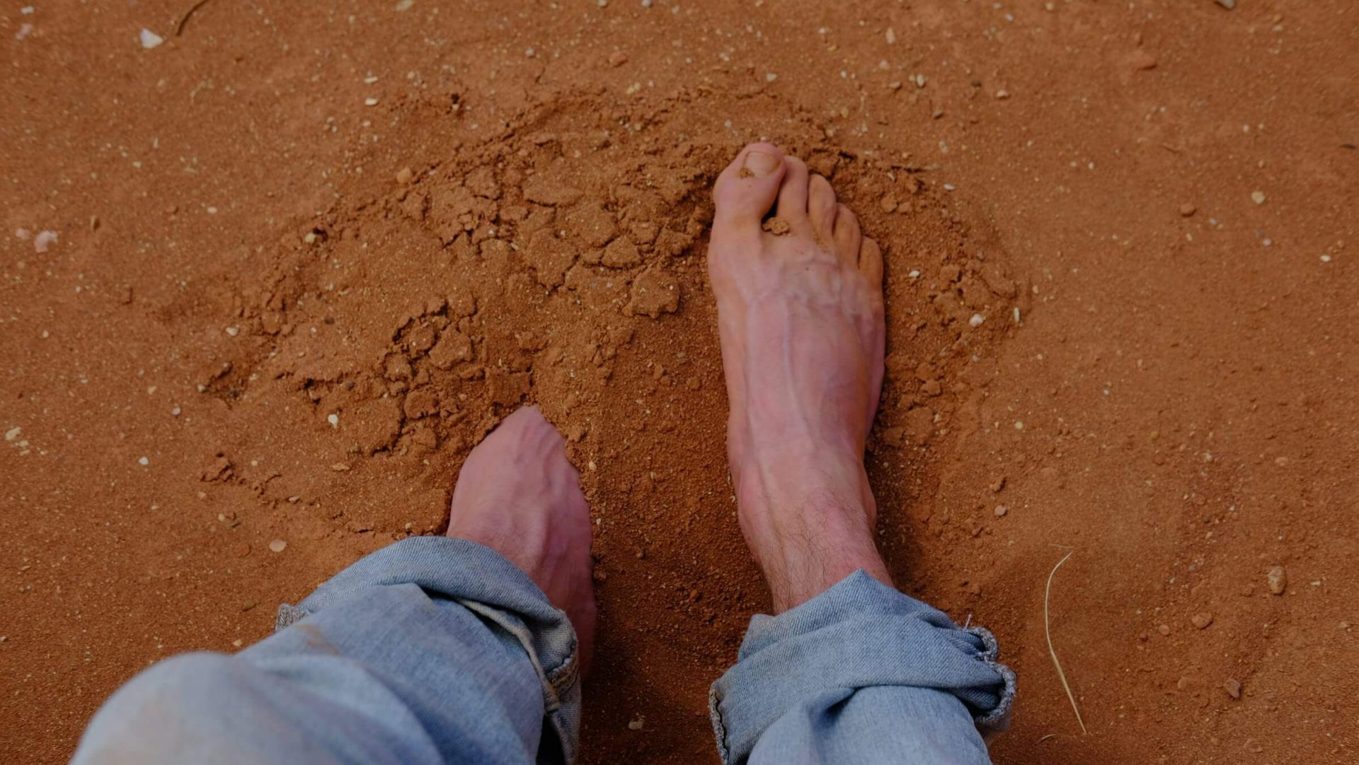 Flat Valgus Foot
